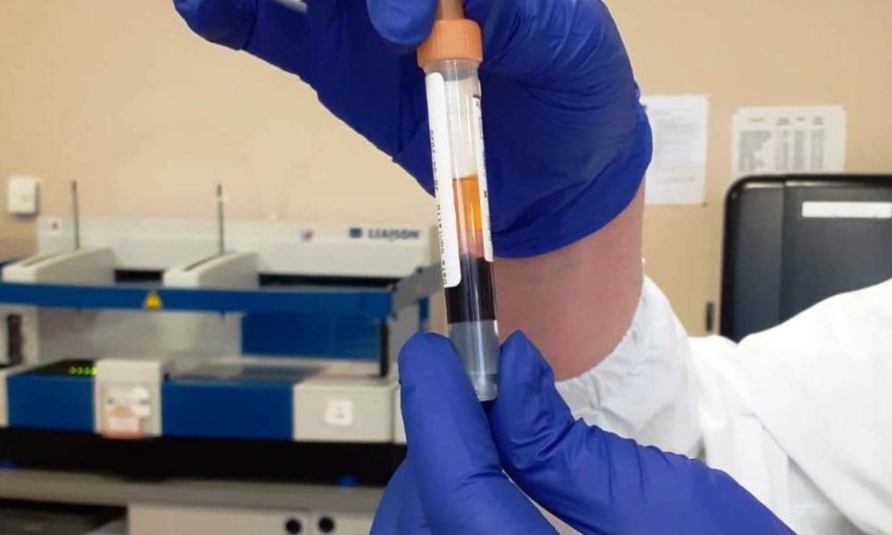 Scuole, i sierologici per il personale: a Como oltre 6mila test, 243 positivi