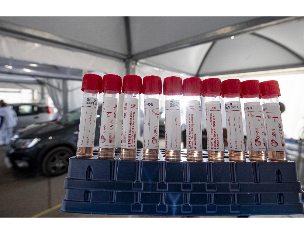 Covid: ancora 10 morti ma contagi in calo in Sardegna