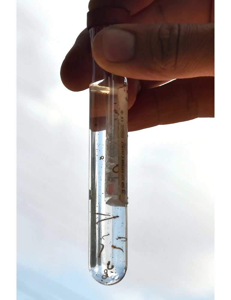 Dengue: il Brasile ora spera, approvato un nuovo vaccino