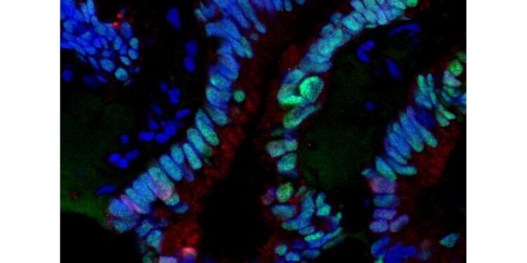 Consente di avere immagini tridimensionali campioni cellulari