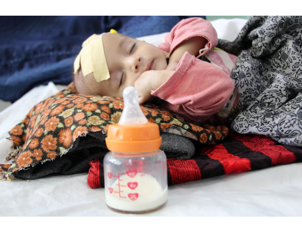 Bbc, con i Talebani al potere 3,2 milioni di bimbi malnutriti