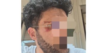 In rete anche il video. Sei feriti