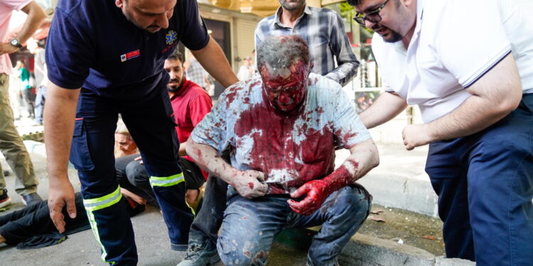 Lo riferisce il ministero iraniano della Salute