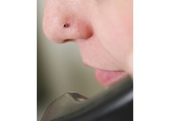 Denuncia per lesioni gravi per la titolare