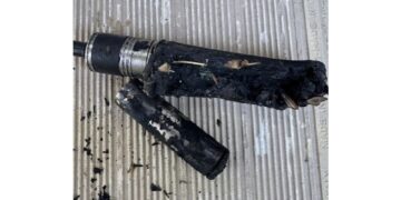 Ustioni a mani e gamba e taglio alla testa. Giovane fa causa