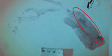 L'assassino si sarebbe appoggiato sulla sommità delle scale