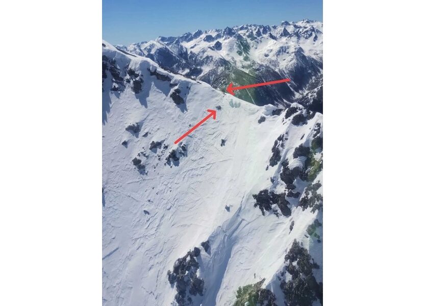 Infortunato ad una gamba