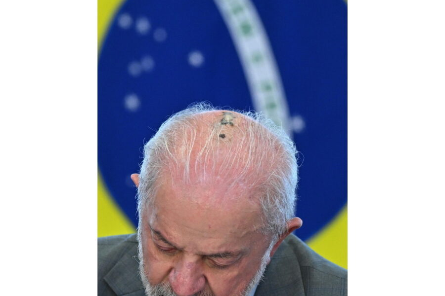 Il presidente brasiliano dovrà sottoporsi a 15 sedute preventive