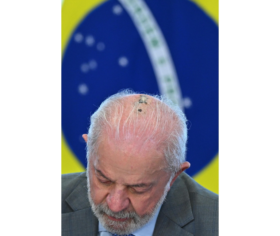 Il presidente brasiliano dovrà sottoporsi a 15 sedute preventive