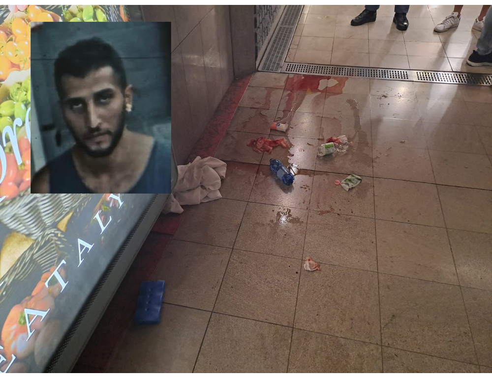 Ragazza sfregiata a Milano, l’aggressore sarà interrogato sabato dal gip