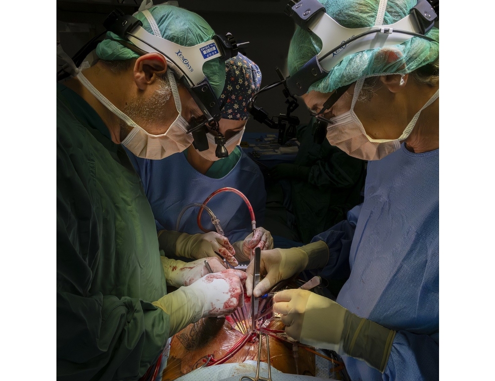 Chirurgia, sostituita bioprotesi al cuore senza aprire il torace