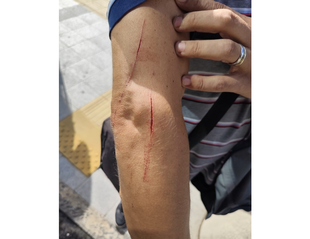 Autista di bus aggredito a Napoli da un uomo con un coltello