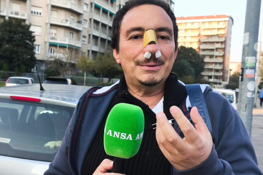 "Mi ha rotto il naso