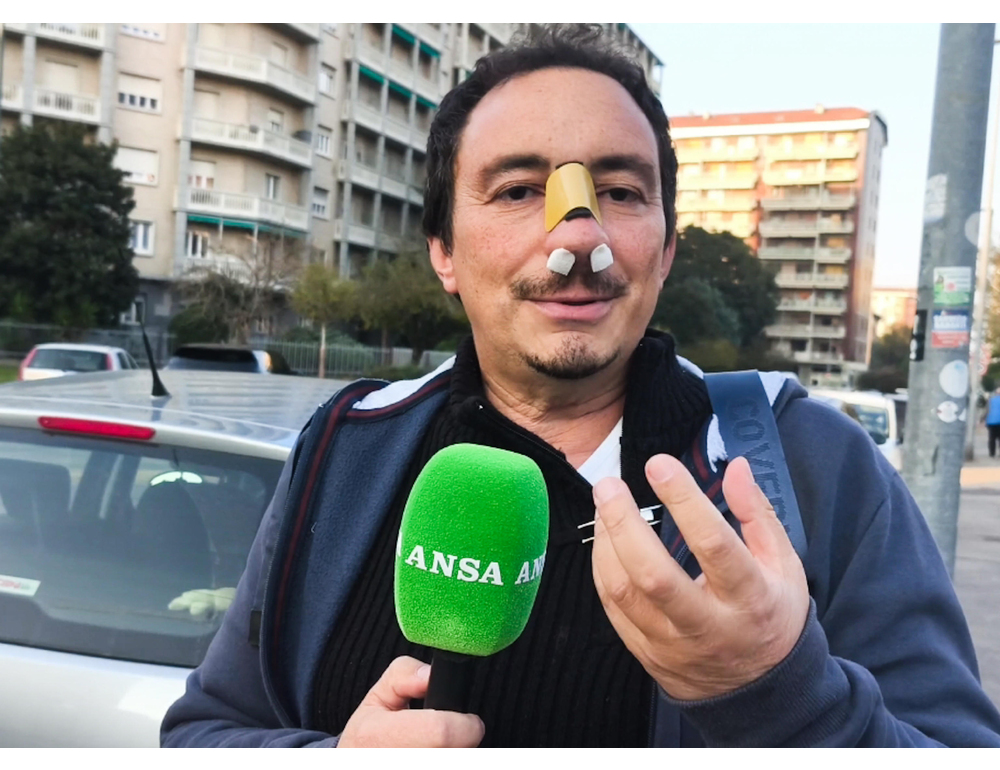Il prof aggredito a Torino, ‘violenza immotivata contro di me’